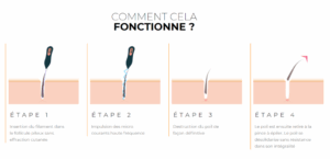 étape d'extraction