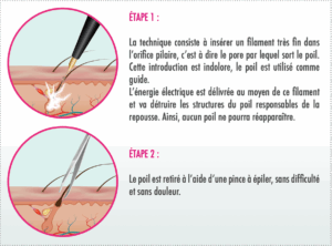 électrolyse