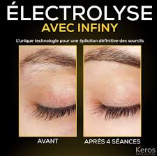 resultat avant apres