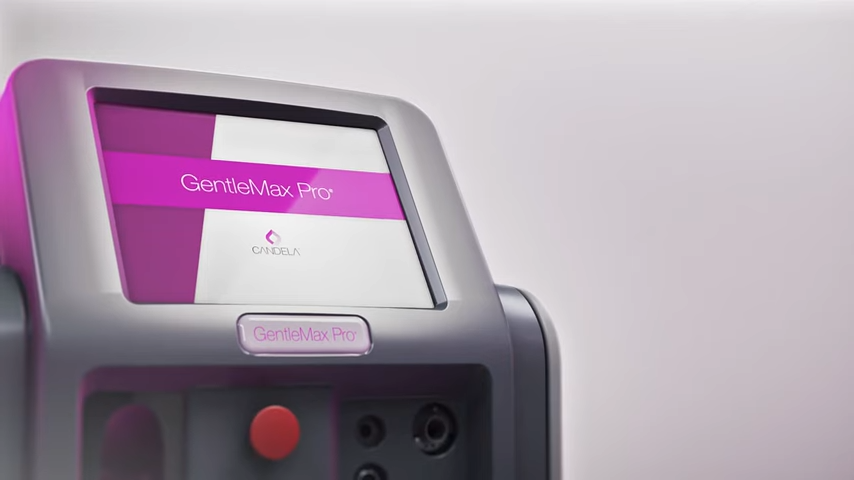 candela laser