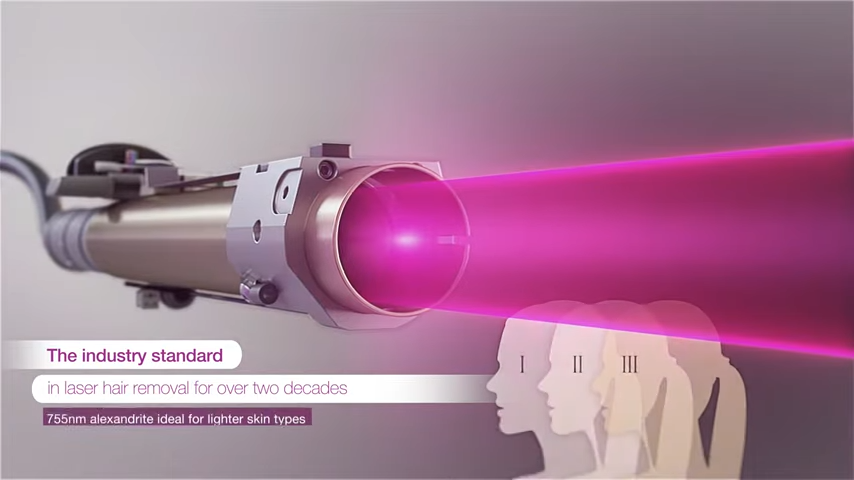candela laser