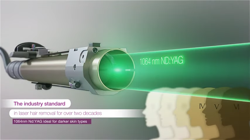 candela laser