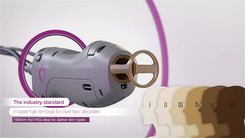 candela laser